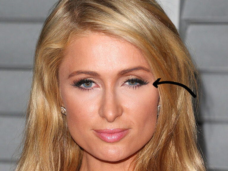 11 famosos con estrabismo (y que no conocías) - Curioseamos.com